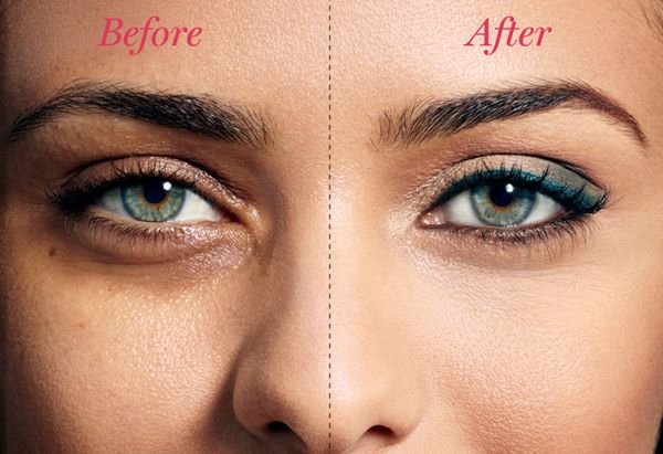 Dark Circles No More! Simple Hacks for Radiant Under-Eyes