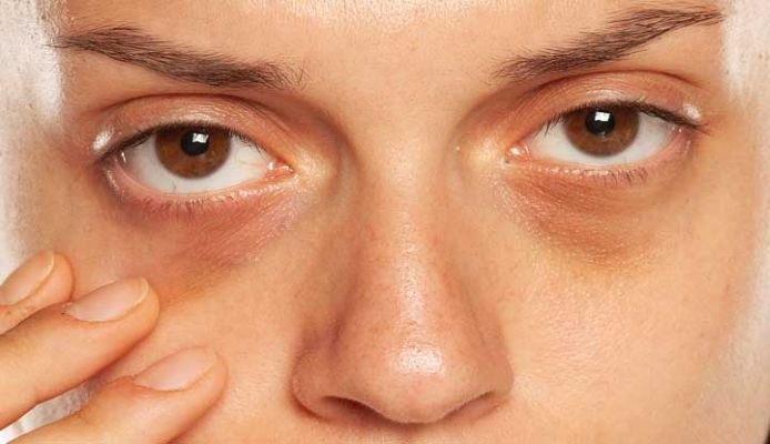 Eye Exercises: How To Brighten Your Under-Eyes